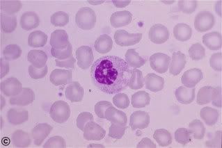 Neutrophil stab